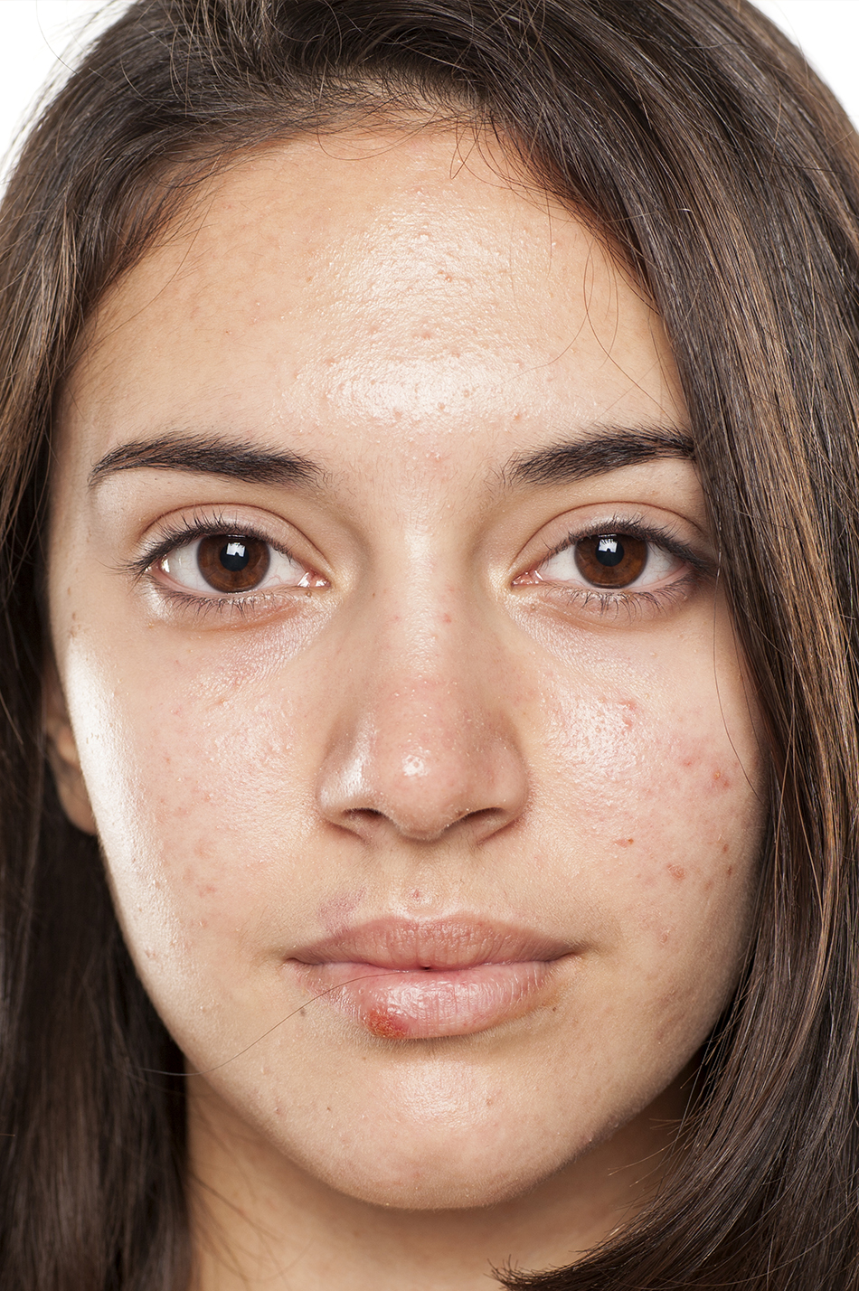 Basic Photo Editing Tips for Beginning Photographers